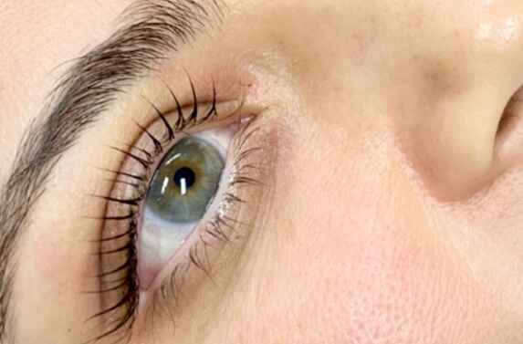Regulate-lash-2